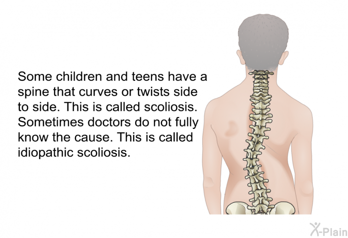 Some children and teens have a spine that curves or twists side to side. This is called scoliosis. Sometimes doctors do not fully know the cause. This is called idiopathic scoliosis.