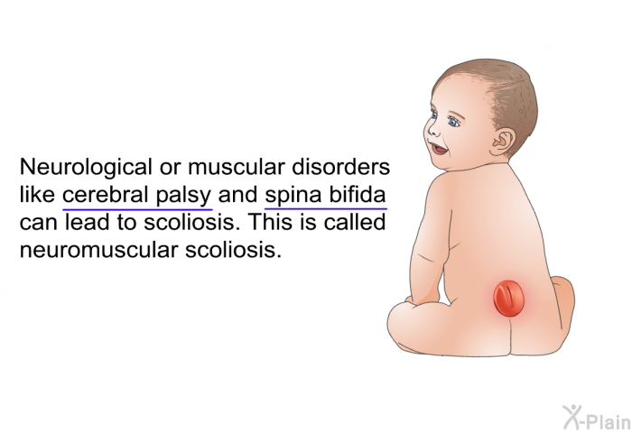 Neurological or muscular disorders like cerebral palsy and spina bifida can lead to scoliosis. This is called neuromuscular scoliosis.
