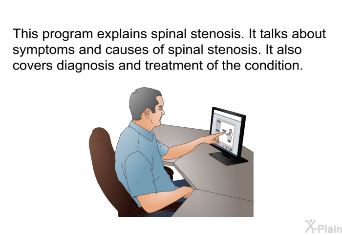 This health information explains spinal stenosis. It talks about symptoms and causes of spinal stenosis. It also covers diagnosis and treatment of the condition.