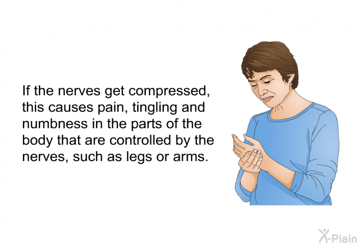 If the nerves get compressed, this causes pain, tingling and numbness in the parts of the body that are controlled by the nerves, such as legs or arms.