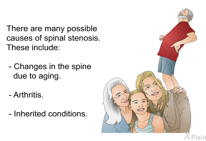 There are many possible causes of spinal stenosis. These include:  Changes in the spine due to aging. Arthritis. Inherited conditions.