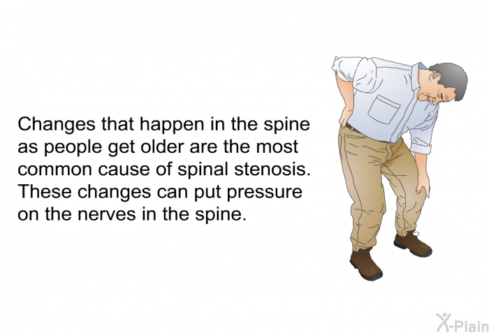 Changes that happen in the spine as people get older are the most common cause of spinal stenosis. These changes can put pressure on the nerves in the spine.