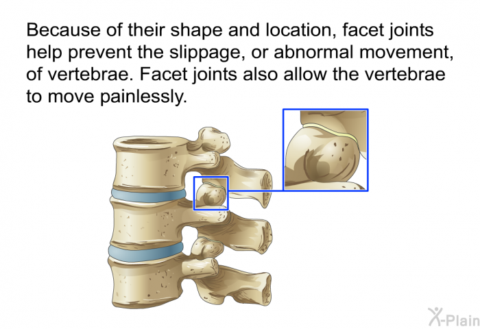 Because of their shape and location, facet joints help prevent the slippage, or abnormal movement, of vertebrae. Facet joints also allow the vertebrae to move painlessly.