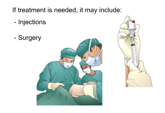 If treatment is needed, it may include:  Injections Surgery