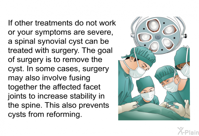 If other treatments do not work or your symptoms are severe, a spinal synovial cyst can be treated with surgery. The goal of surgery is to remove the cyst. In some cases, surgery may also involve fusing together the affected facet joints to increase stability in the spine. This also prevents cysts from reforming.