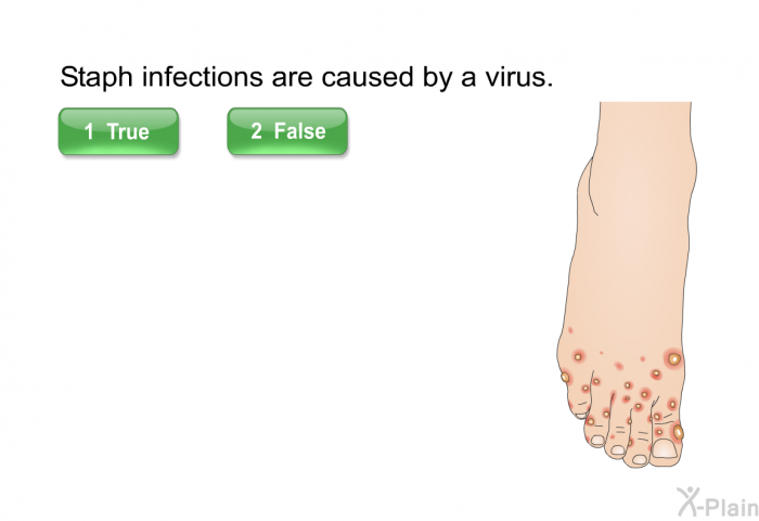 Staph infections are caused by a virus. Select True or False.
