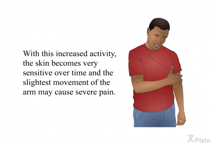 With this increased activity, the skin becomes very sensitive over time, and the slightest movement of the arm may cause severe pain.