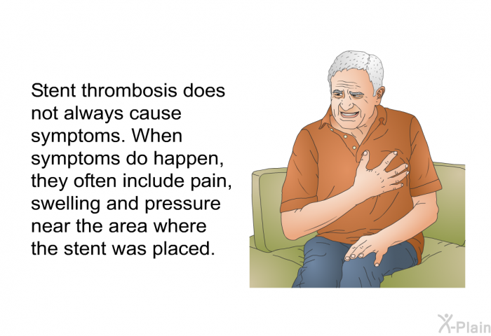 Stent thrombosis does not always cause symptoms. When symptoms do happen, they often include pain, swelling and pressure near the area where the stent was placed.