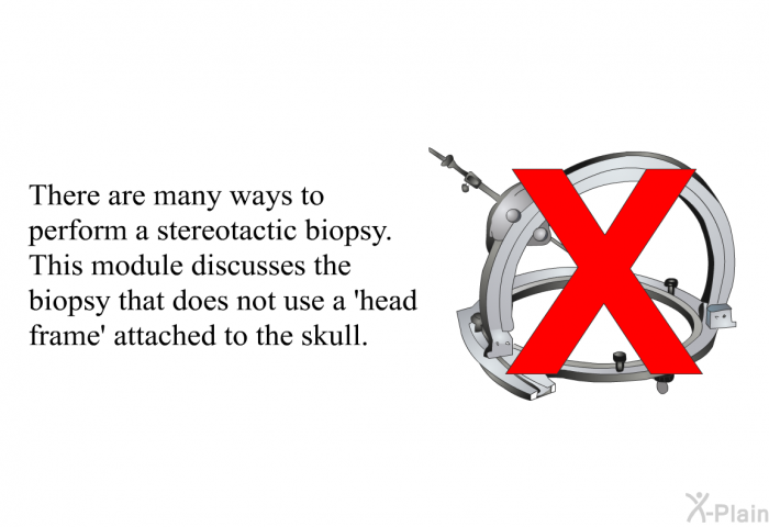 There are many ways to perform a stereotactic biopsy. This module discusses the biopsy that does not use a  head frame' attached to the skull.