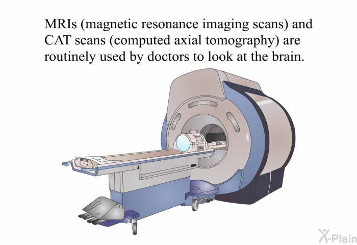 MRIs (magnetic resonance imaging scans) and CAT scans (computed axial tomography) are routinely used by doctors to look at the brain.