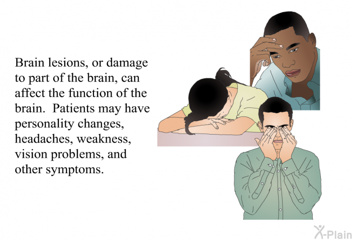 Brain lesions, or damage to part of the brain, can affect the function of the brain. Patients may have personality changes, headaches, weakness, vision problems, and other symptoms.