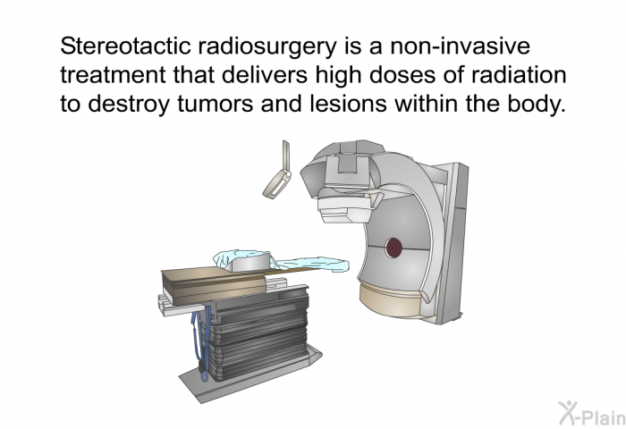 Stereotactic radiosurgery is a non-invasive treatment that delivers high doses of radiation to destroy tumors and lesions within the body.