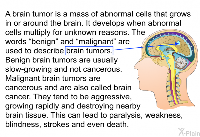 A brain tumor is a mass of abnormal cells that grows in or around the brain. It develops when abnormal cells multiply for unknown reasons. The words “benign” and “malignant” are used to describe brain tumors. Benign brain tumors are usually slow-growing and not cancerous. Malignant brain tumors are cancerous and are also called brain cancer. They tend to be aggressive, growing rapidly and destroying nearby brain tissue. This can lead to paralysis, weakness, blindness, strokes and even death.