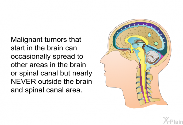 Malignant tumors that start in the brain can occasionally spread to other areas in the brain or spinal canal but nearly NEVER outside the brain and spinal canal area.