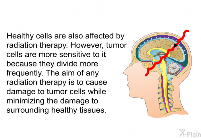 Healthy cells are also affected by radiation therapy. However, tumor cells are more sensitive to it because they divide more frequently. The aim of any radiation therapy is to cause damage to tumor cells while minimizing the damage to surrounding healthy tissues.