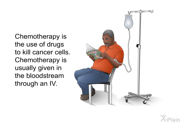 Chemotherapy is the use of drugs to kill cancer cells. Chemotherapy is usually given in the bloodstream through an IV.