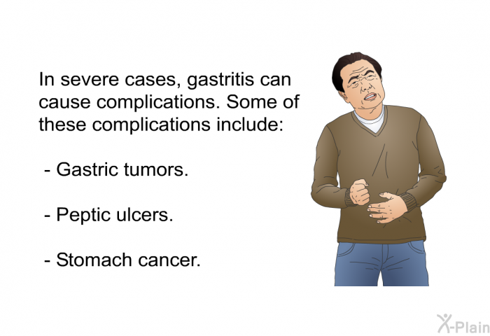In severe cases, gastritis can cause complications. Some of these complications include:  Gastric tumors. Peptic ulcers. Stomach cancer.