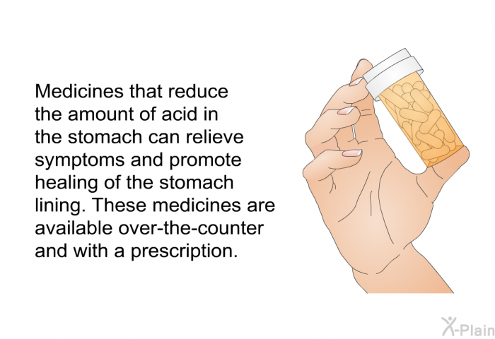 Medicines that reduce the amount of acid in the stomach can relieve symptoms and promote healing of the stomach lining. These medicines are available over-the-counter and with a prescription.
