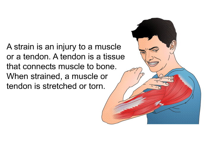 A strain is an injury to a muscle or a tendon. A tendon is a tissue that connects muscle to bone. When strained, a muscle or tendon is stretched or torn.