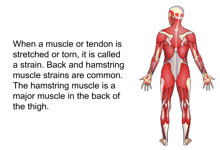 When a muscle or tendon is stretched or torn, it is called a strain. Back and hamstring muscle strains are common. The hamstring muscle is a major muscle in the back of the thigh.