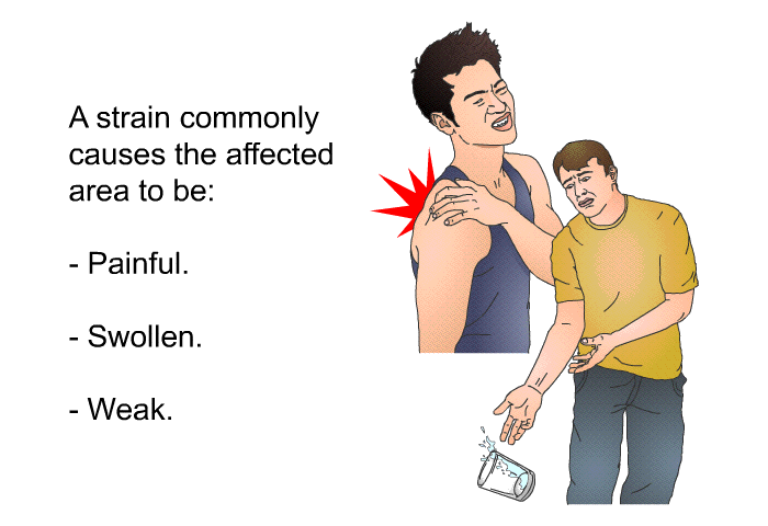A strain commonly causes the affected area to be:  Painful. Swollen. Weak.