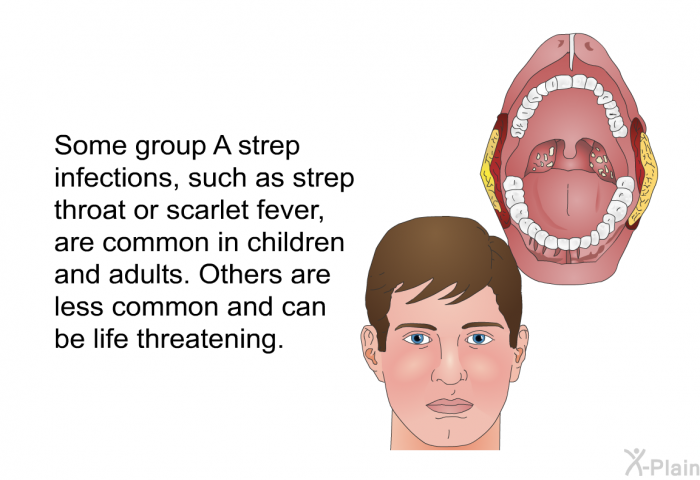 Some group A strep infections, such as strep throat or scarlet fever, are common in children and adults. Others are less common and can be life threatening.