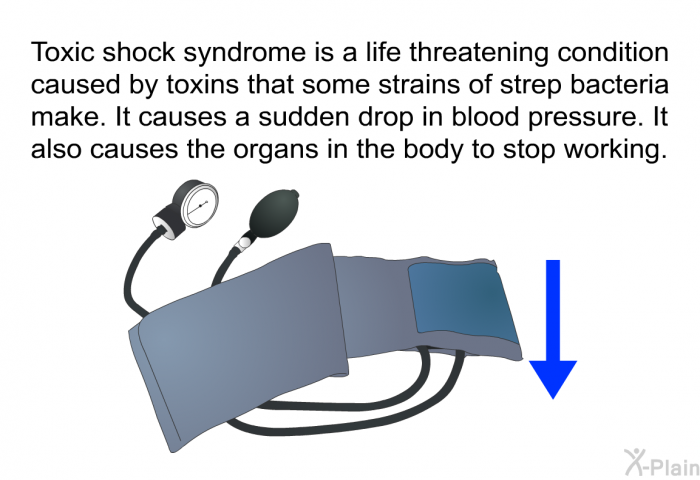 Toxic shock syndrome is a life threatening condition caused by toxins that some strains of strep bacteria make. It causes a sudden drop in blood pressure. It also causes the organs in the body to stop working.