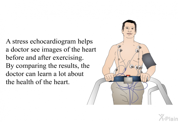 A stress echocardiogram helps a doctor see images of the heart before and after exercising. By comparing the results, the doctor can learn a lot about the health of the heart.