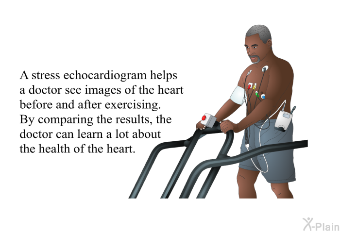 A stress echocardiogram helps a doctor see images of the heart before and after exercising. By comparing the results, the doctor can learn a lot about the health of the heart.