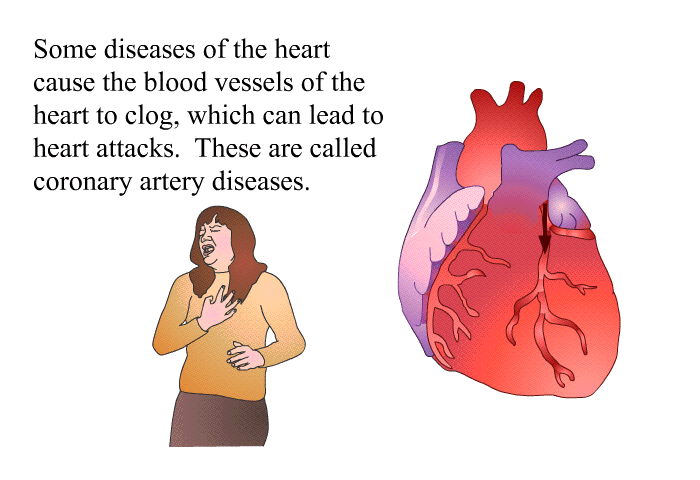 Some diseases of the heart cause the blood vessels of the heart to clog, which can lead to heart attacks. These are called coronary artery diseases.