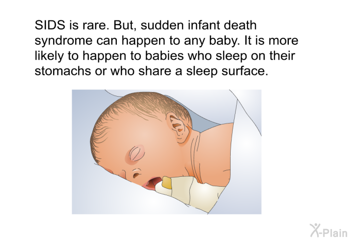 SIDS is rare. But, sudden infant death syndrome can happen to any baby. It is more likely to happen to babies who sleep on their stomachs or who share a sleep surface.