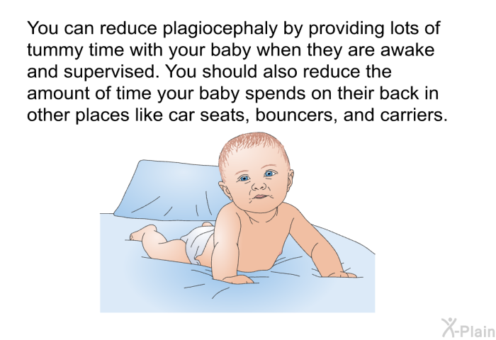 You can reduce plagiocephaly by providing lots of tummy time with your baby when they are awake and supervised. You should also reduce the amount of time your baby spends on their back in other places like car seats, bouncers and carriers.