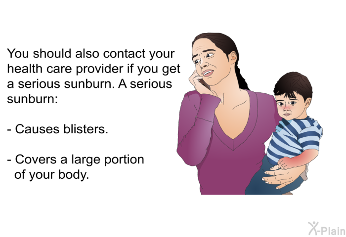 You should also contact your health care provider if you get a serious sunburn. A serious sunburn:  Causes blisters. Covers a large portion of your body.