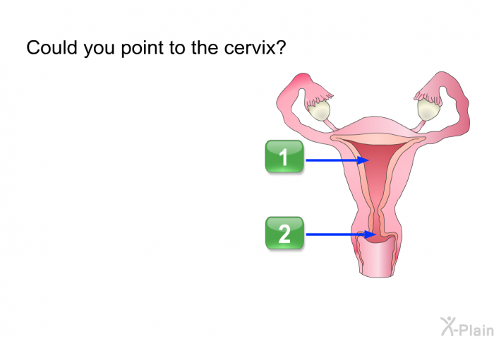 Could you point to the cervix? Press A or B