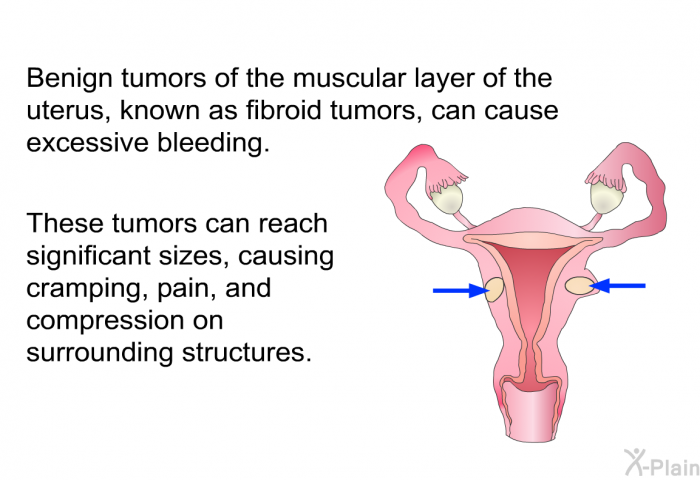 Benign tumors of the muscular layer of the uterus, known as fibroid tumors, can cause excessive bleeding. These tumors can reach significant sizes, causing cramping, pain, and compression on surrounding structures.