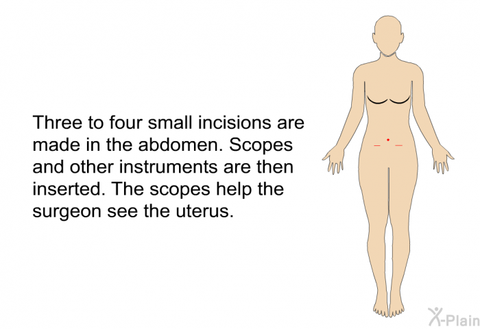 Three to four small incisions are made in the abdomen. Scopes and other instruments are then inserted. The scopes help the surgeon see the uterus.