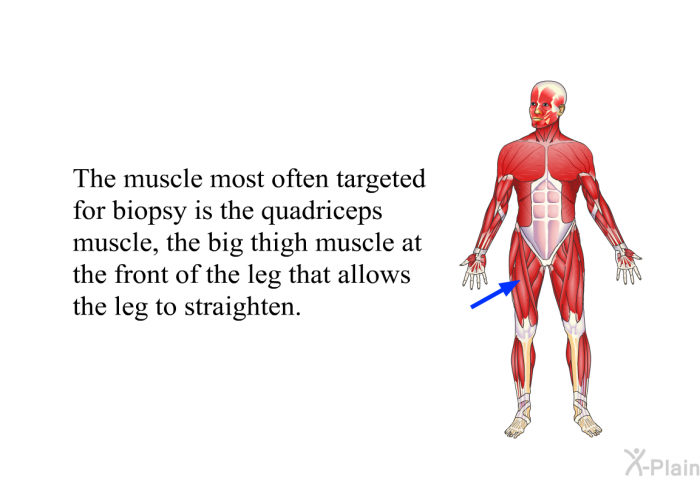 The muscle most often targeted for biopsy is the quadriceps muscle, the big thigh muscle at the front of the leg that allows the leg to straighten.