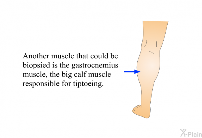 Another muscle that could be biopsied is the gastrocnemius muscle, the big calf muscle responsible for tiptoeing.