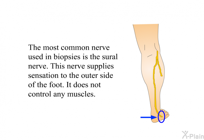 The most common nerve used in biopsies is the sural nerve. This nerve supplies sensation to the outer side of the foot. It does not control any muscles.