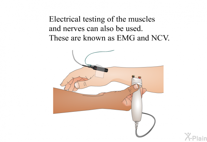 Electrical testing of the muscles and nerves can also be used. These are known as EMG and NCV.