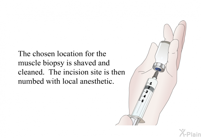 The chosen location for the muscle biopsy is shaved and cleaned. The incision site is then numbed with local anesthetic.