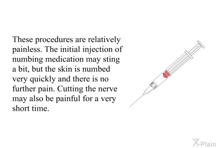 These procedures are relatively painless. The initial injection of numbing medication may sting a bit, but the skin is numbed very quickly and there is no further pain. Cutting the nerve may also be painful for a very short time.