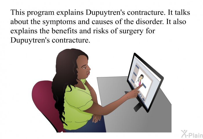 This health information explains Dupuytren's contracture. It talks about the symptoms and causes of the disorder. It also explains the benefits and risks of surgery for Dupuytren's contracture.