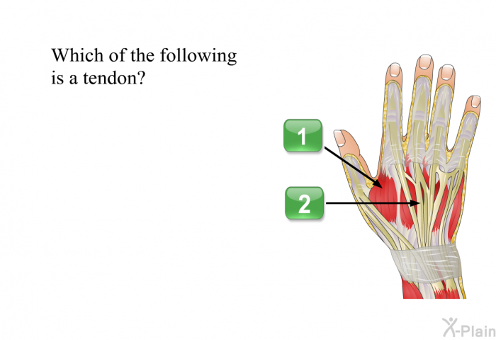 Which of the following is a tendon?