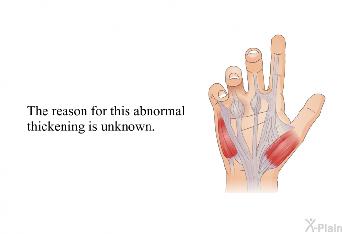 The reason for this abnormal thickening is unknown.