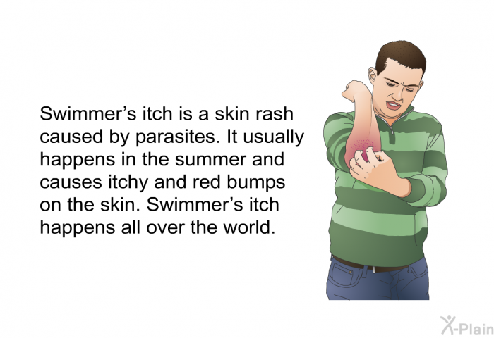 Swimmer's itch is a skin rash caused by parasites. It usually happens in the summer and causes itchy and red bumps on the skin. Swimmer's itch happens all over the world.