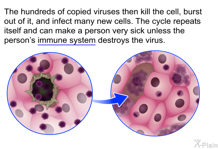 The hundreds of copied viruses then kill the cell, burst out of it, and infect many new cells. The cycle repeats itself and can make a person very sick unless the person's immune system destroys the virus.