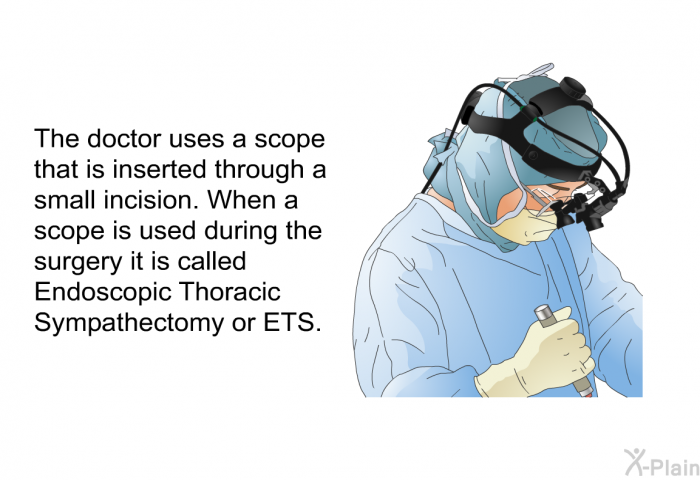 The doctor uses a scope that is inserted through a small incision. When a scope is used during the surgery it is called Endoscopic Thoracic Sympathectomy or ETS.