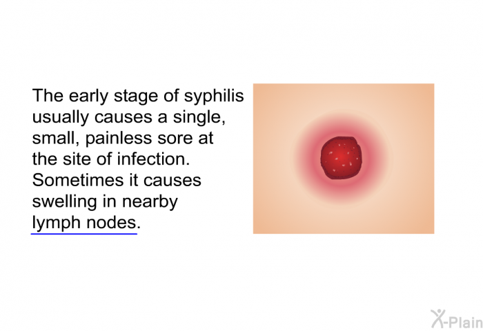 The early stage of syphilis usually causes a single, small, painless sore at the site of infection. Sometimes it causes swelling in nearby lymph nodes.