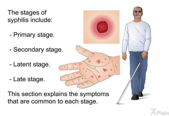 The stages of syphilis include:  Primary stage. Secondary stage. Latent stage. Late stage.  
 This section explains the symptoms that are common to each stage.